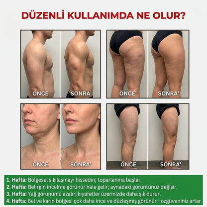 Sıkılaştırıcı & Yağ Yakıcı Korse